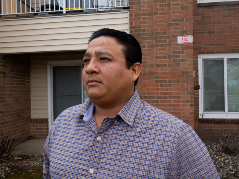 José Alfredo Gómez standing in front of his home. He has a large scar on his forehead from falling two stories while working on a construction site.