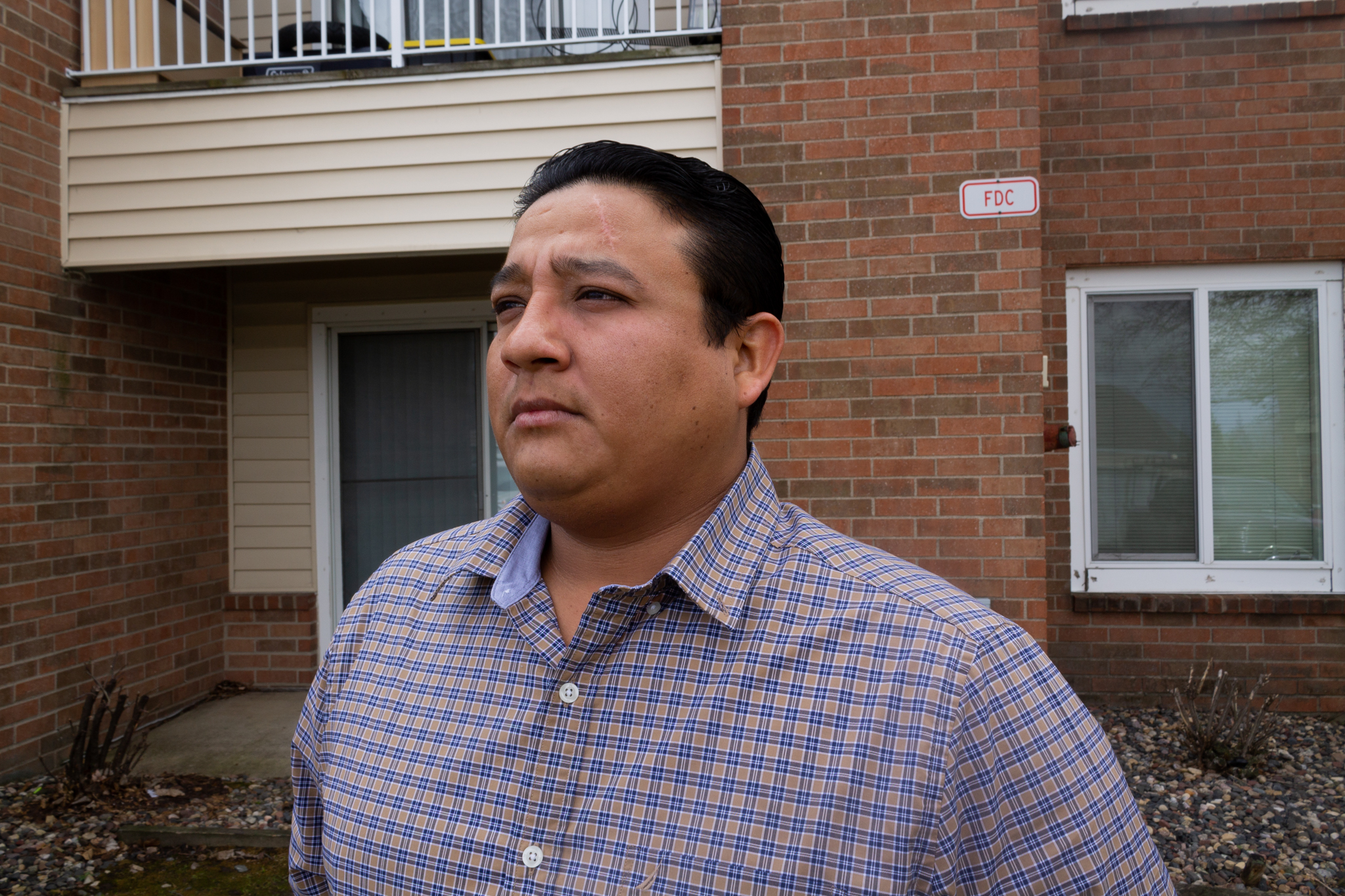 José Alfredo Gómez standing in front of his home. He has a large scar on his forehead from falling two stories while working on a construction site.